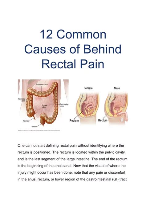 super tight anus|Anal pain Causes .